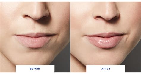 dior lip plumper before and after|dior lip plumper reviews.